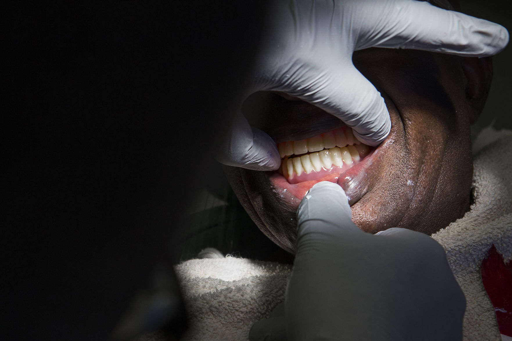 Exchange Inmate Dentures